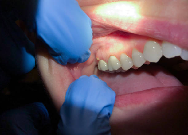 Emergency Dentist Open Today in SC