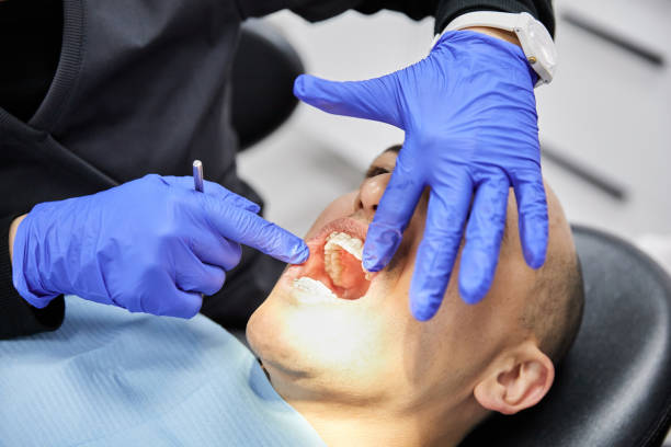 Best Knocked-Out Tooth Emergency  in Homewood, SC